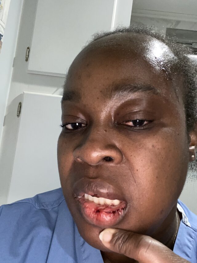 Woman beaten by tenant